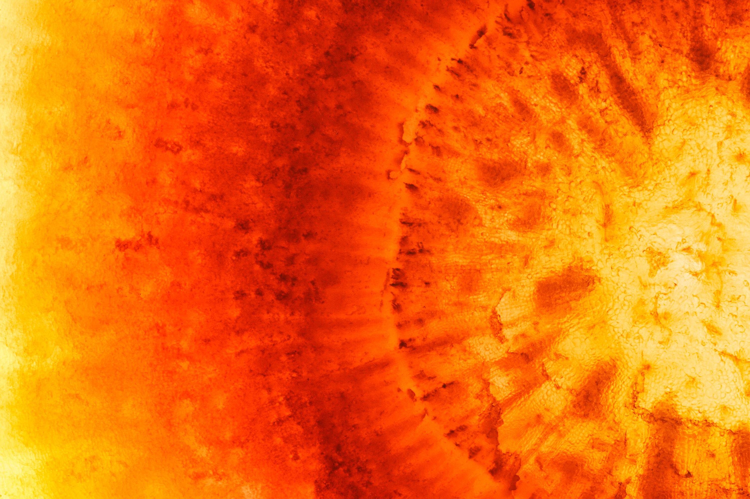 Endometriosis — A Mystery Disease