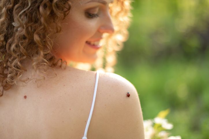 Melanoma: Reality, Myths, and a Few Numbers