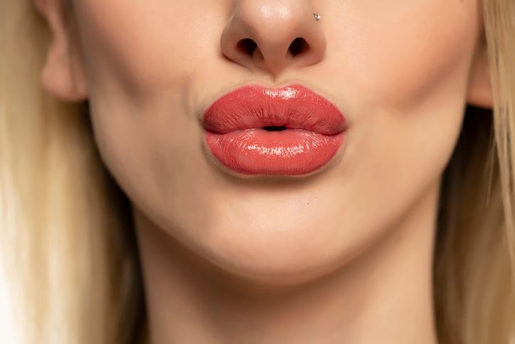 Lip Augmentation Without Complications: 10 Rules