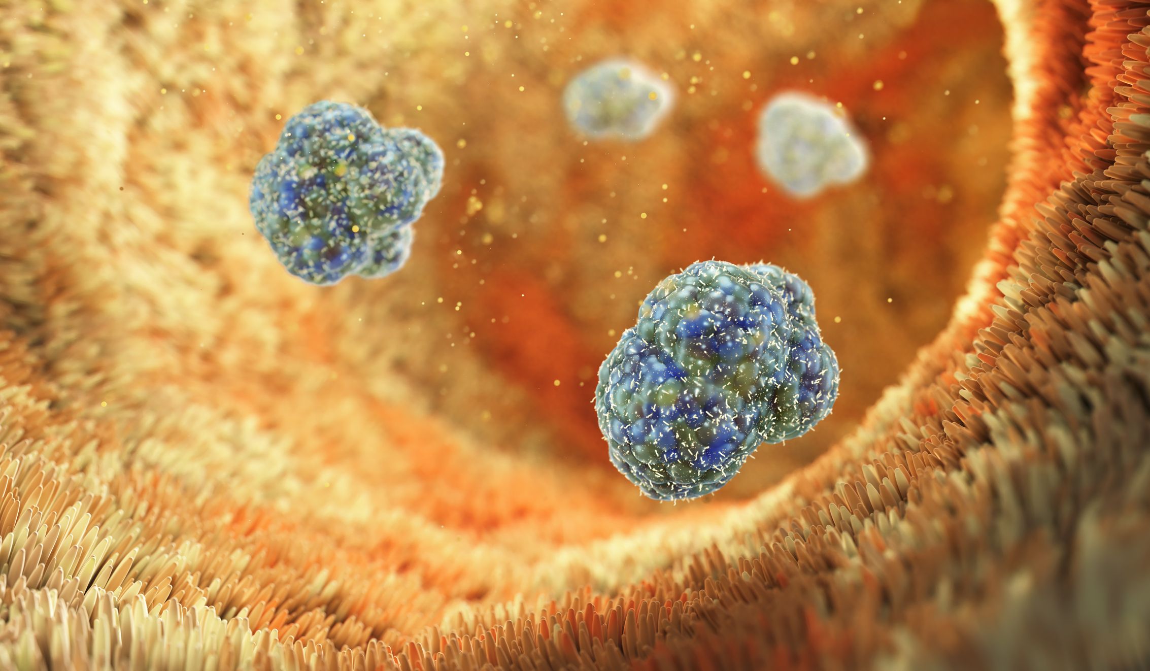 4 Common Questions About Cholecystitis