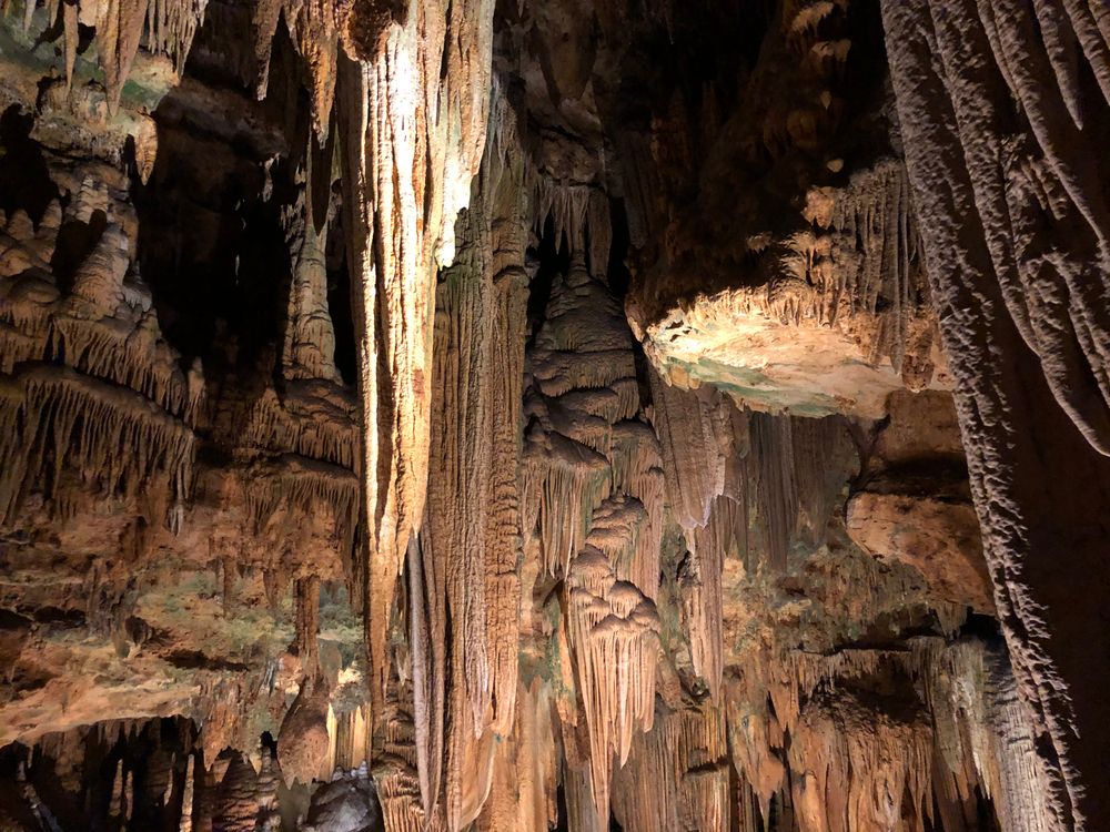 Gout: The Disease of the Well-Fed